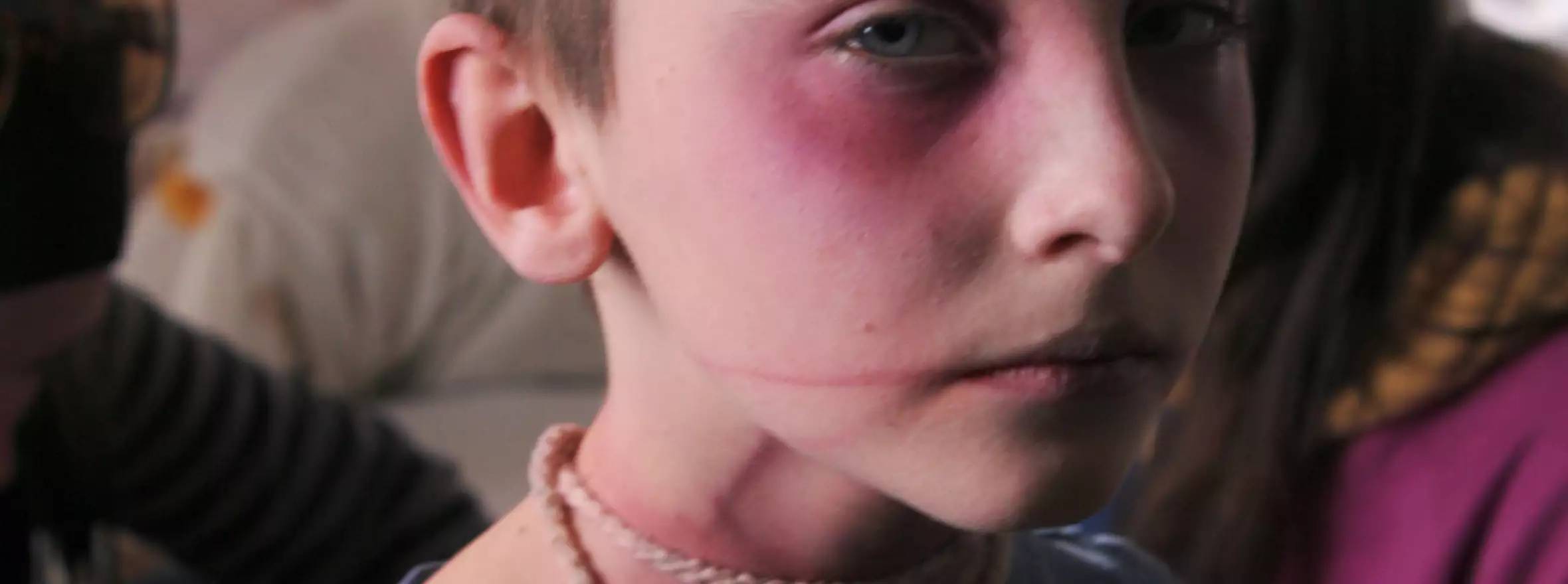 Abused